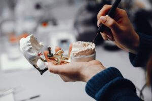 Изготовление бюгельных зубных протезов