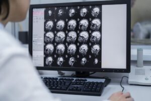 Актуальные вопросы дуплексного сканирования сосудов головы и шеи
